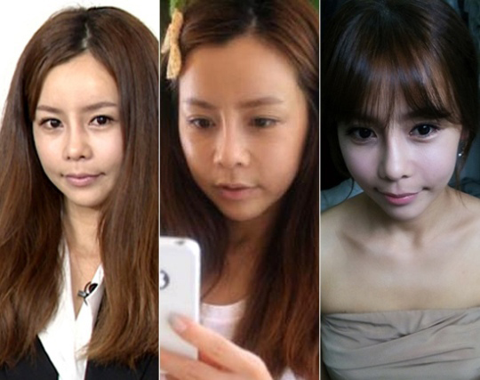 元コメディー女優シニの顔変遷史 あご整形の驚きのパワー Joongang Ilbo 中央日報