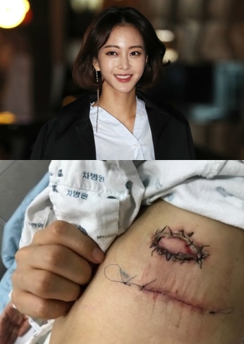 女優ハン・イェスル（上）と、ハン・イェスルが医療事故に遭ったとしてＳＮＳに掲載した写真（下）。