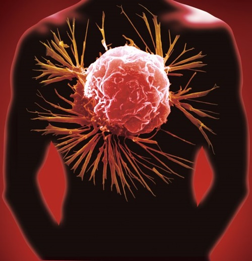 韓国研究陣が４５歳未満で発生する早期発病胃がんの原因を明らかにした。（写真＝中央フォト）