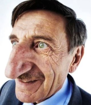 写真 世界で最も大きな鼻を持つトルコ人 Joongang Ilbo 中央日報