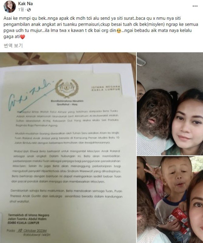 「狼男症候群」を持つミスクリエンちゃんの両親がマレーシア王妃から届いた手紙を公開した。［Ｆａｃｅｂｏｏｋ　キャプチャー］