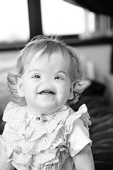 先天性無鼻症で生まれたテッサ・エバンスさんの赤ちゃん時代。［フェイスブック　キャプチャー］