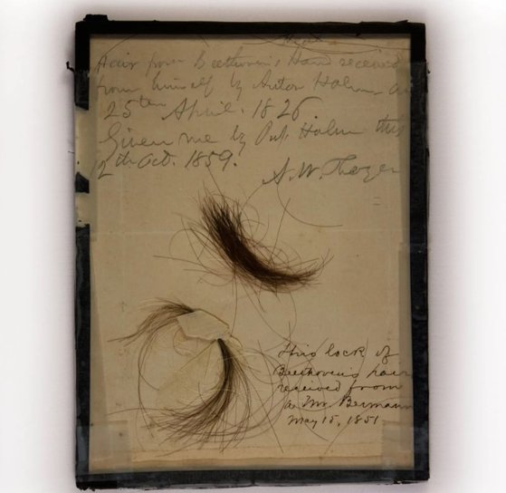 ２つの認証されたベートーヴェンの髪の毛から髪の毛１グラム当たり驚くべき水準の鉛が含まれていることが明らかになった。［ホームページ　キャプチャー］