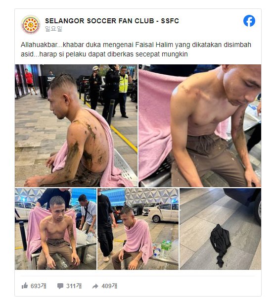 ５日（現地時間）、マレーシア代表の主力選手ファイサル・ハリム（２６）がマレーシアの首都クアラルンプール近隣コタダマンサラのショッピングモールで塩酸をかけられる事件が発生した。　［フェイスブック　キャプチャー］