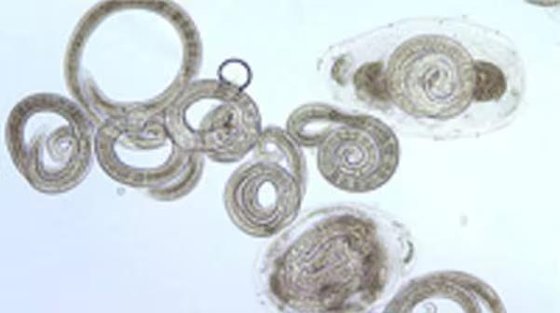 旋毛虫［米国疾病予防管理センター（ＣＤＣ）のホームページ　キャプチャー］