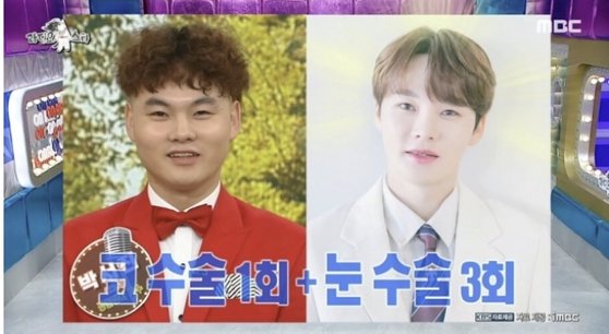 トロット歌手パク・ソジン（整形前が左）