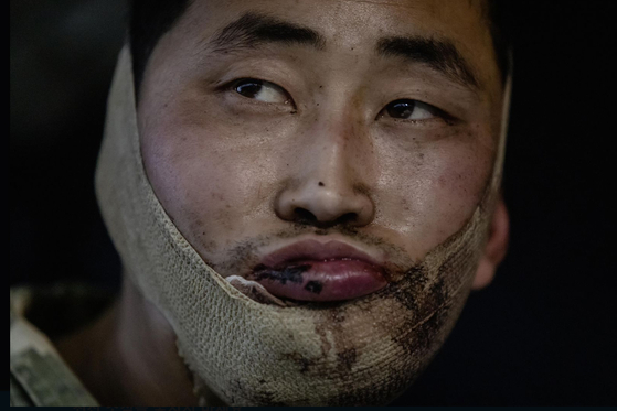 ウクライナ軍の捕虜になった北朝鮮兵　［ゼレンスキー大統領　Ｘ キャプチャー］