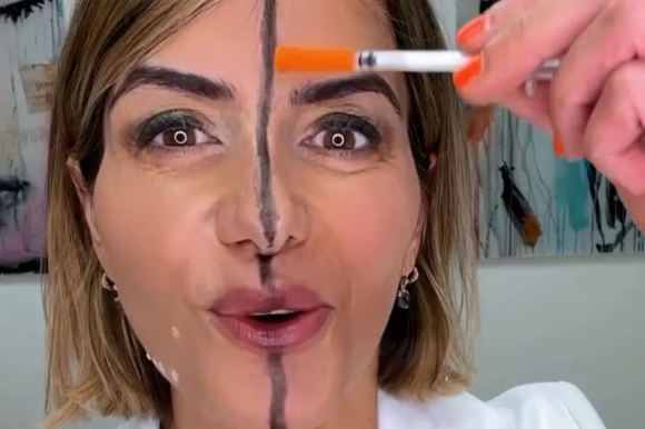 自分の顔の片方にだけボトックス注射を打ち、「半分実験」の映像を公開したビタ・ファレル博士。［写真　ＳＮＳ］  ​