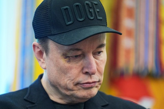 目の周りに紫色のあざができたマスク氏。［写真　ＡＰ＝聯合ニュース］