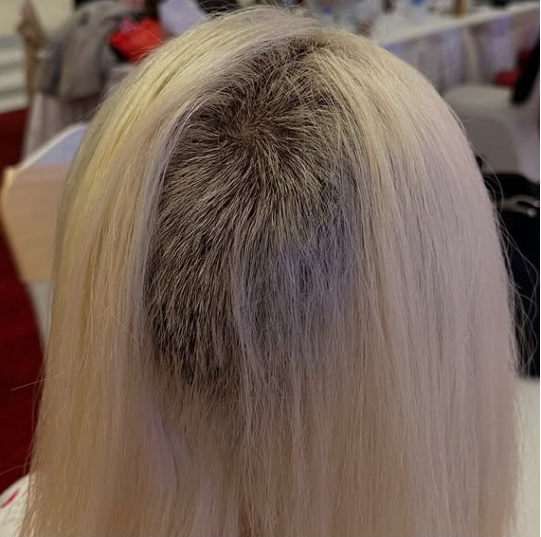 ブリーチ施術に失敗して坊主頭になったＤＪ　ＳＯＤＡ。［写真　ＳＮＳ］ ​