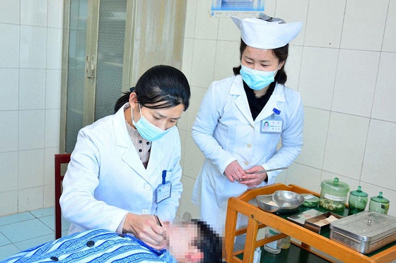 治療目的で整形手術をする北朝鮮の医師　［聯合ニュース］
