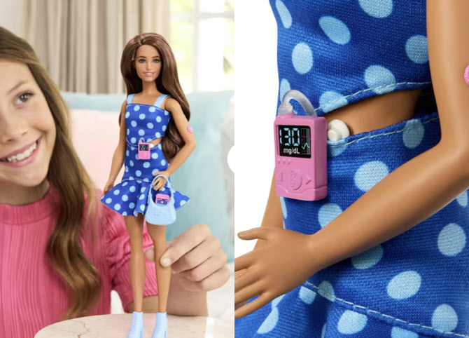 米国玩具メーカーのマテル（Ｍａｔｔｅｌ）社が発売した「１型糖尿病バービー人形」［写真　マテル］