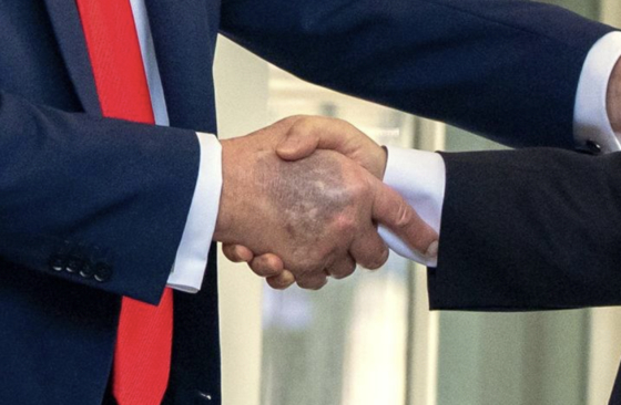 韓米首脳会談当時、ドナルド・トランプ米大統領の手の甲に確認されたアザ。［写真　ニューシス］