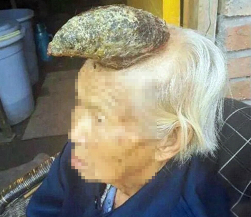 頭部に生じた腫瘍の資料写真 ［写真sns］