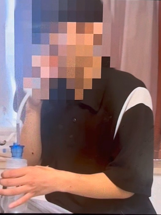   犯罪組織の拷問を受け死亡した大学生と見られる人物の姿［テレグラム「犯罪との戦争2」チャンネル　キャプチャー］