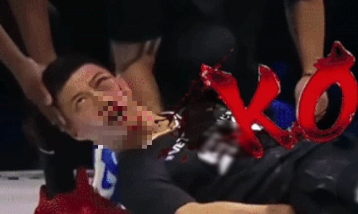 パワースラップ大会で頬を打たれ意識を失った中国通背拳の継承者。［写真 SNS］