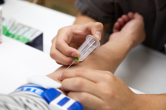 肝炎検査のために採血する様子。中央フォト