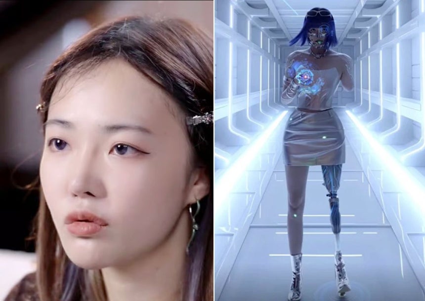 腕と脚を失いながらも、障害者の経済的自立を支援する事業を展開している中国のインフルエンサー、翁忻怡さん。［写真 抖音］