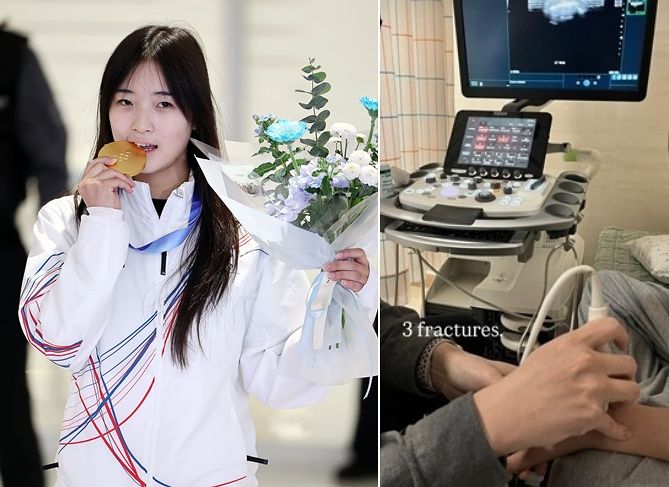 2026年ミラノ・コルティナダンペッツォ冬季オリンピック（五輪）のスノーボード女子ハーフパイプで金メダルを獲得したチェ・ガオンが、病院での検査結果の写真を投稿した。［写真 聯合ニュース、チェ・ガオンのインスタグラム キャプチャー］