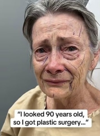 フェイスリフトをする前の70代の米国人女性 ［写真 sns］