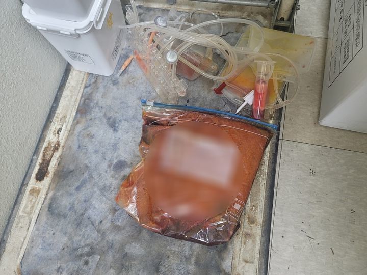  ジッパー付き保存袋に入れられた人体の廃脂肪。［写真 ソウル市］