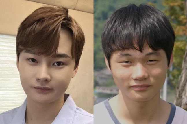   歌手パク・ソジンの整形前後の姿 ［写真 KBS2『家事をする男たち シーズン2』］